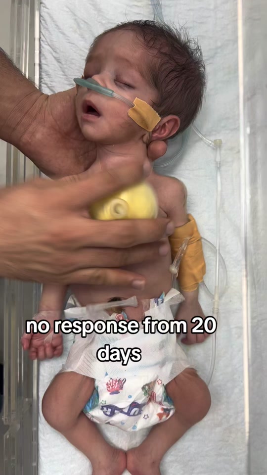 baby not responding from 20 days thumbnail from TikTok