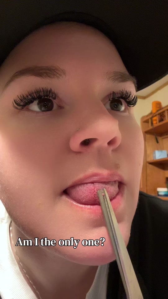 I HATE a swollen taste bud. thumbnail from TikTok